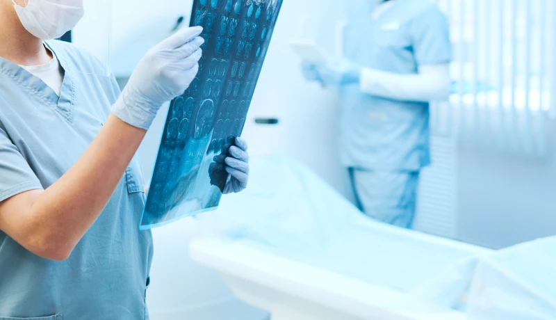 Plano de saúde cobre pet scan: o que fazer em caso de negativa