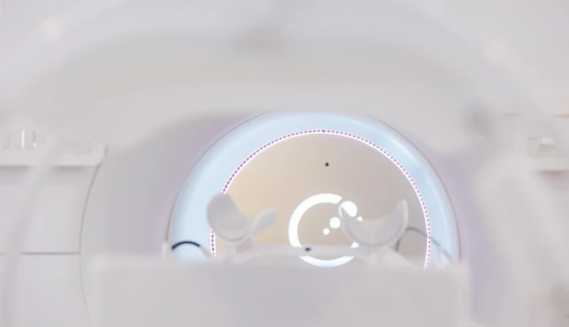 Plano de saúde deve cobrir radioterapia por intensidade modulada (IMRT)