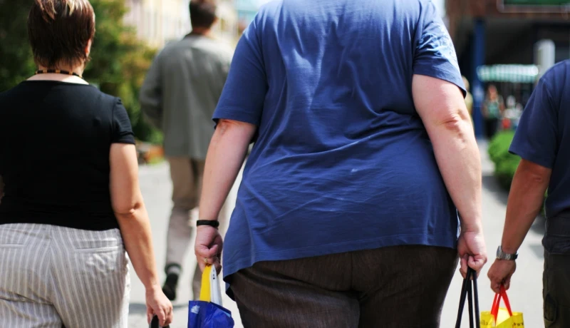 Plano de saúde não pode negar cirurgia para obesidade mórbida