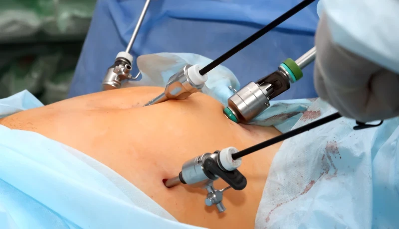 Justiça determina que convênio autorize cirurgia para tratamento de obesidade