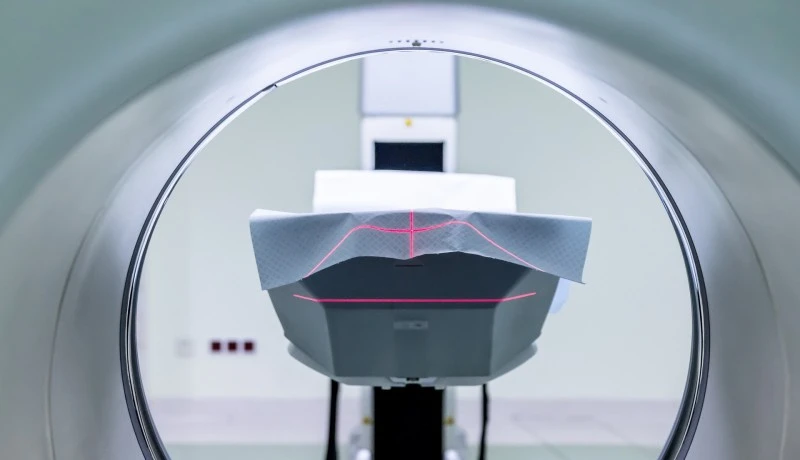 Plano de Saúde cobre radioterapia